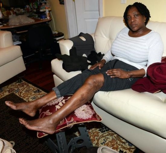 美國怎么處理電梯“吃人”？賠死你