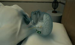 Snore Circle智能止鼾設備登錄眾籌：終于能睡個好覺