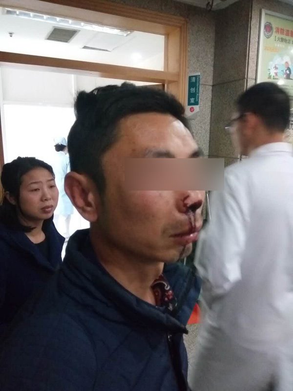 快遞員稱叫收件人實(shí)名簽收遭暴打，警方：已立案調(diào)查